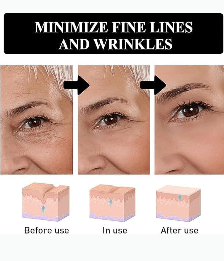 ITZEllA® Instant Eye Lift